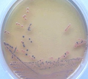 實(shí)驗(yàn)室常用微生物菌種的分離和純化方法